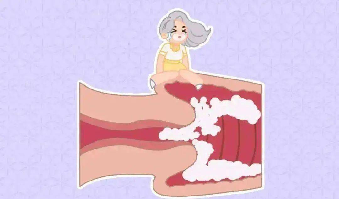 阴道歉深处很痒是怎么回事?