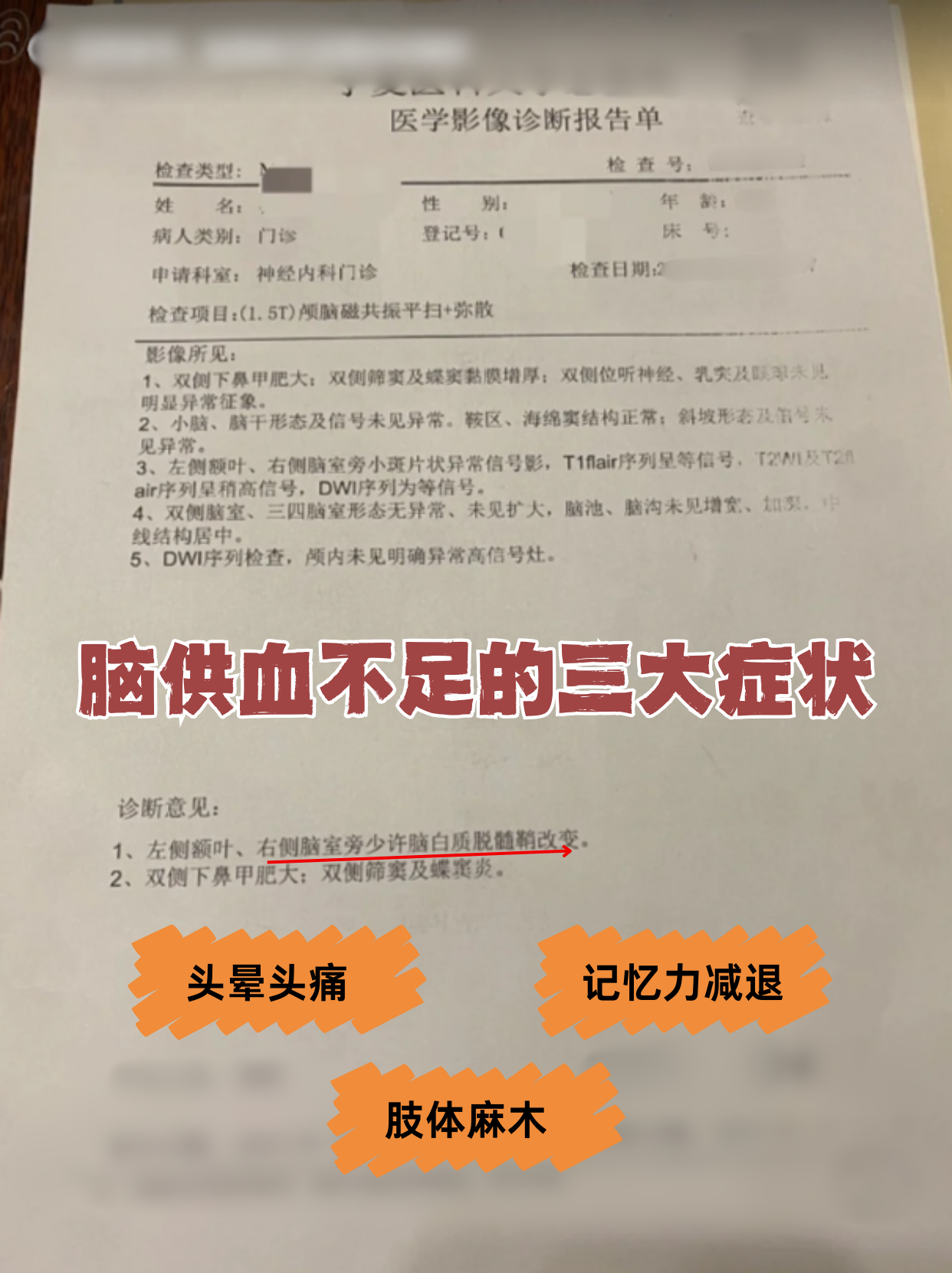 脑供血不足的治疗方法