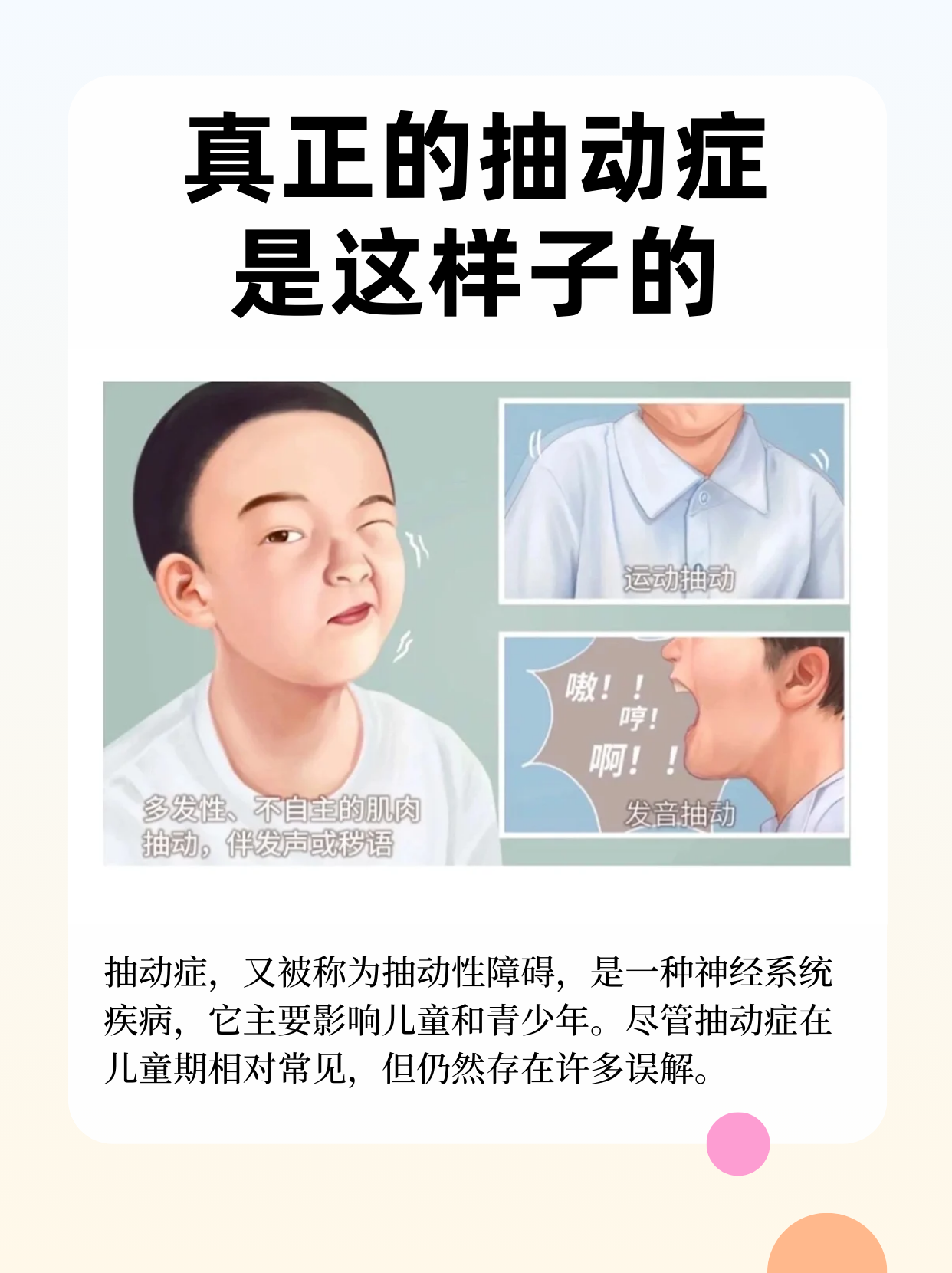 多动症的孩子更聪明吗?