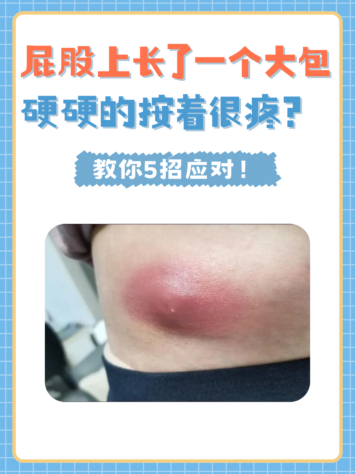 滑车上淋巴结肿大有什么症状