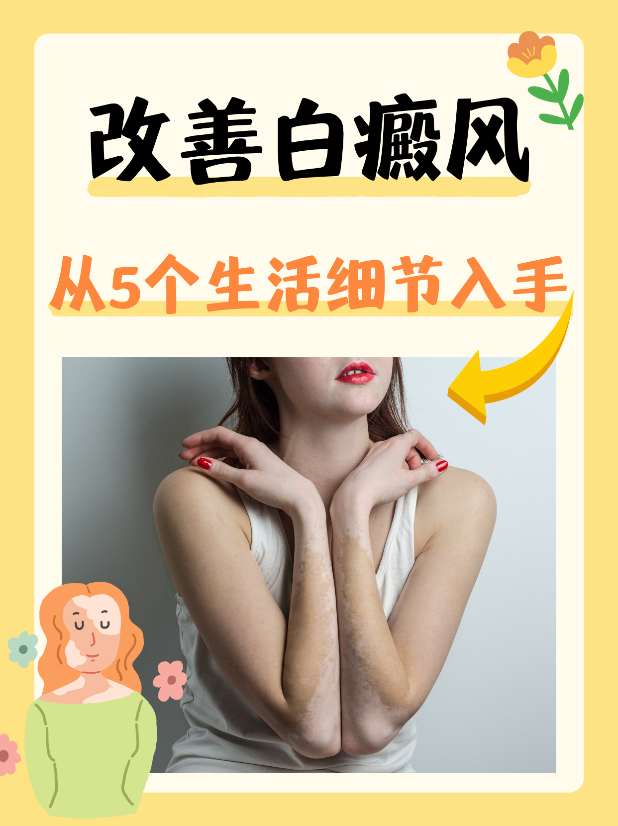 白癜风终于治好了