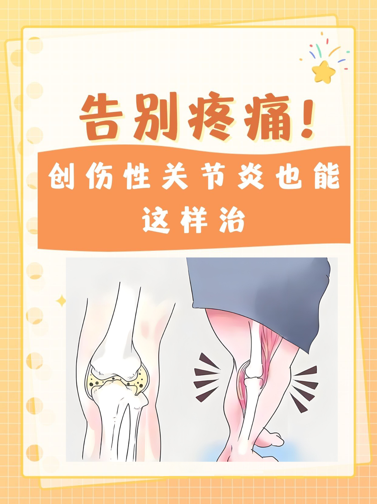 关节炎能治好吗