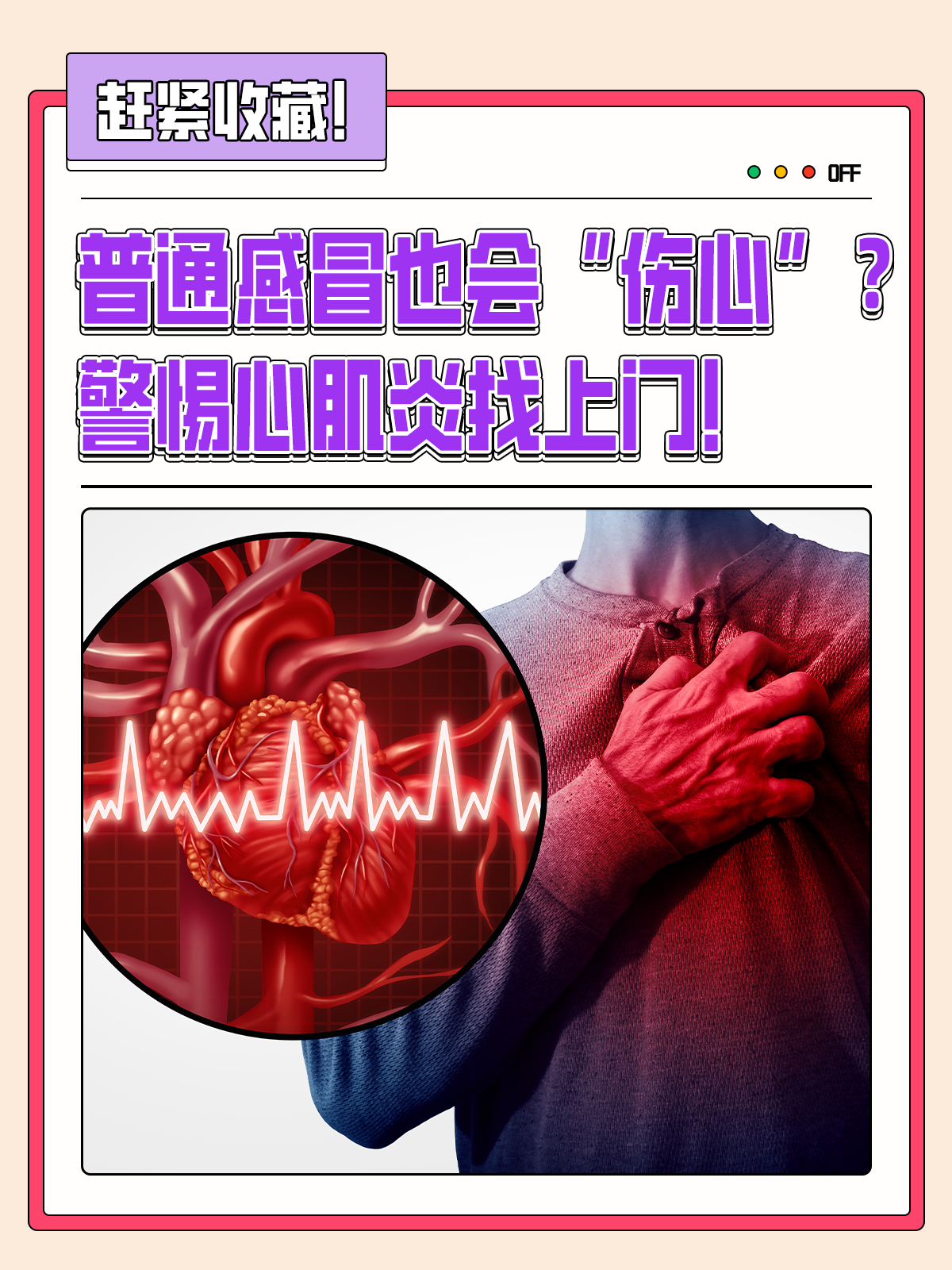 病毒性心肌炎有哪些症状