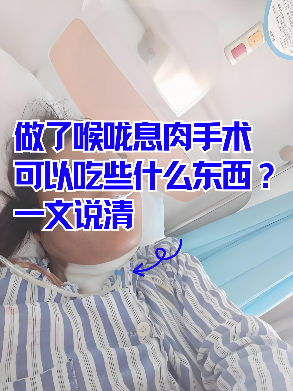 声带息肉怎么做手术