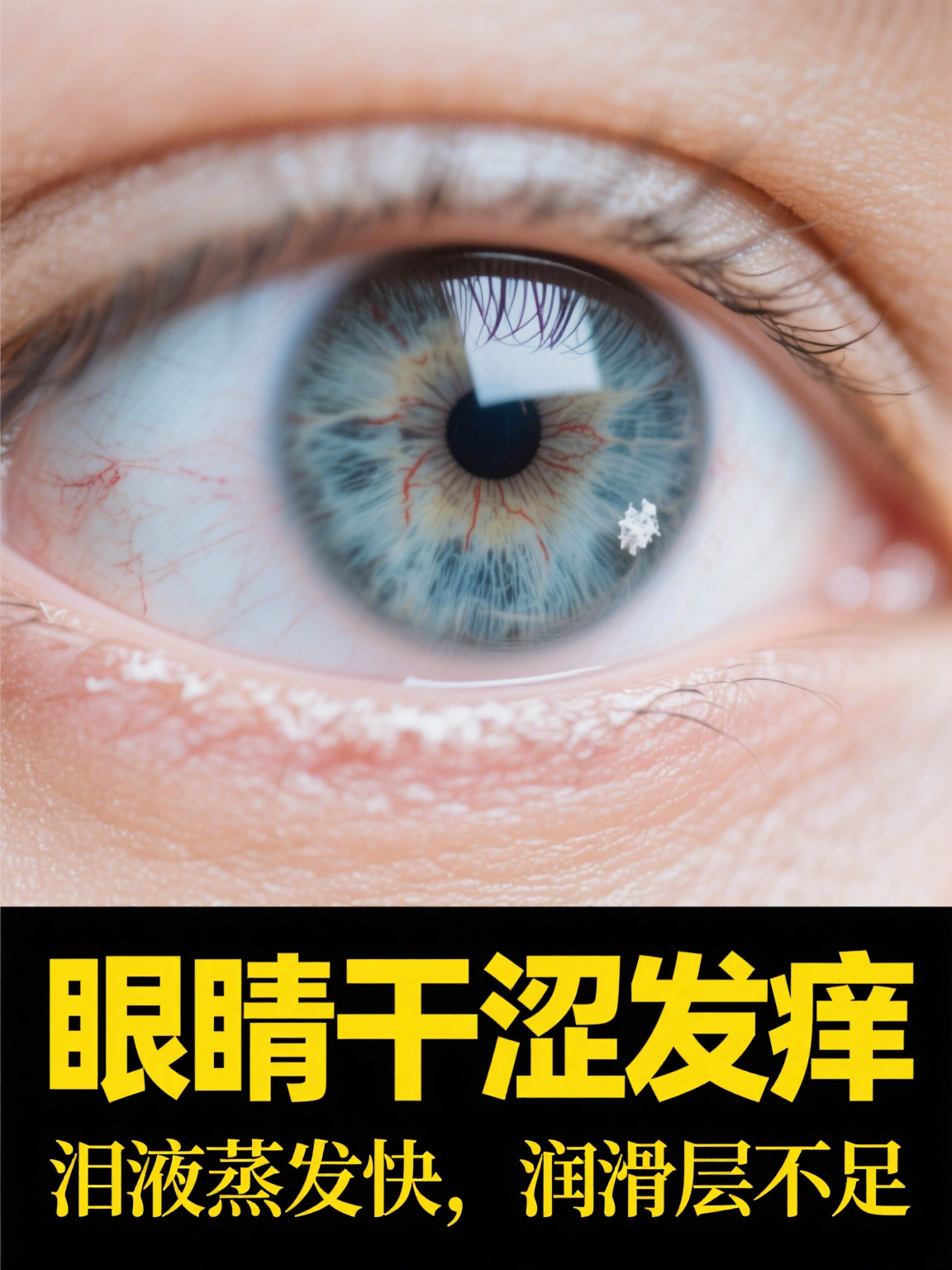 眼睛干涩,发痒是怎么回事?