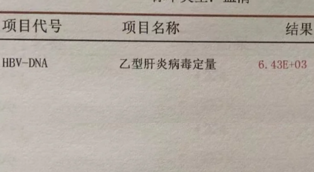 乙肝DNA检验单怎么看