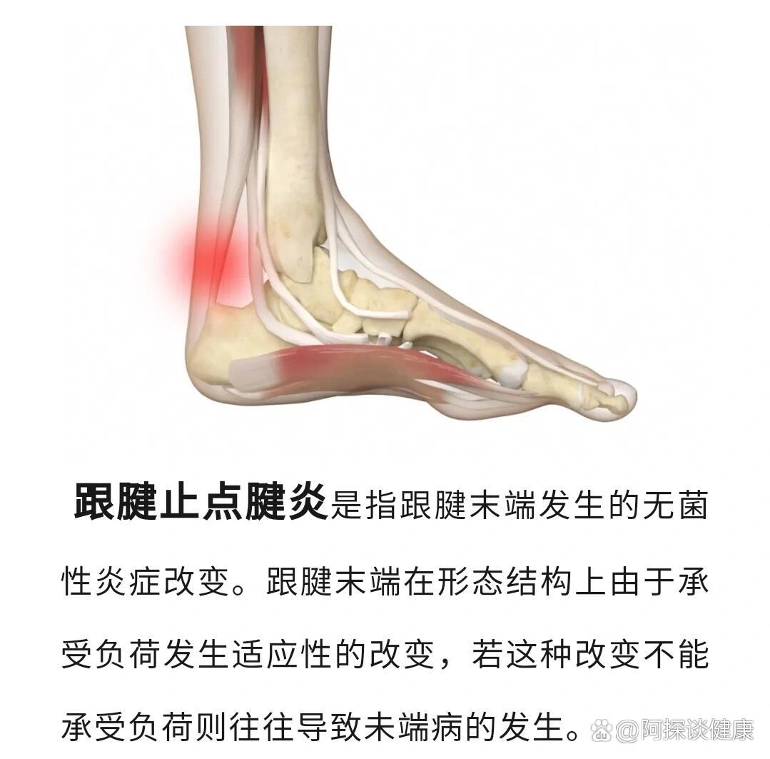 怎样才能让跟腱明显?就是脚后跟那