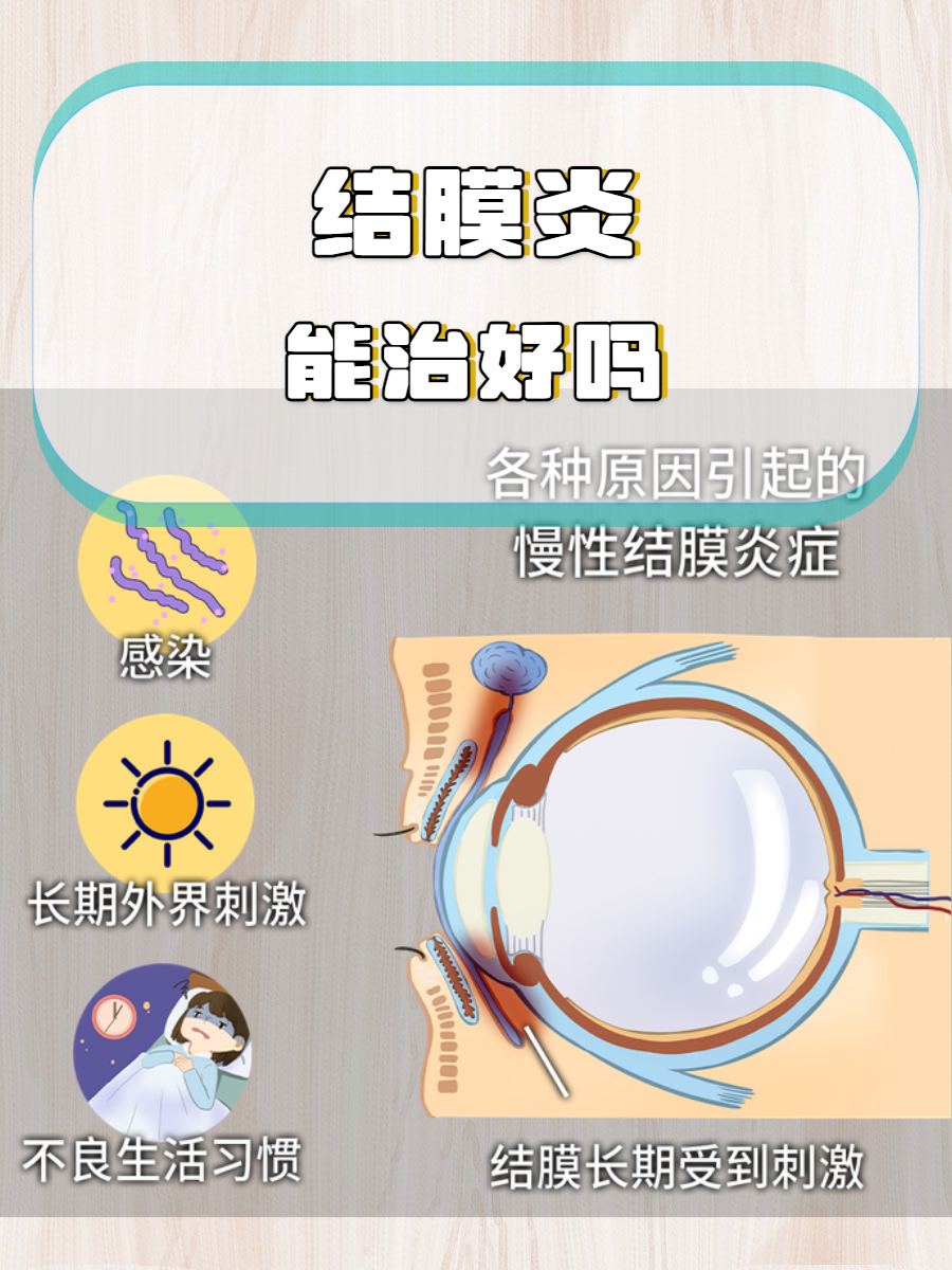 结膜炎严重吗