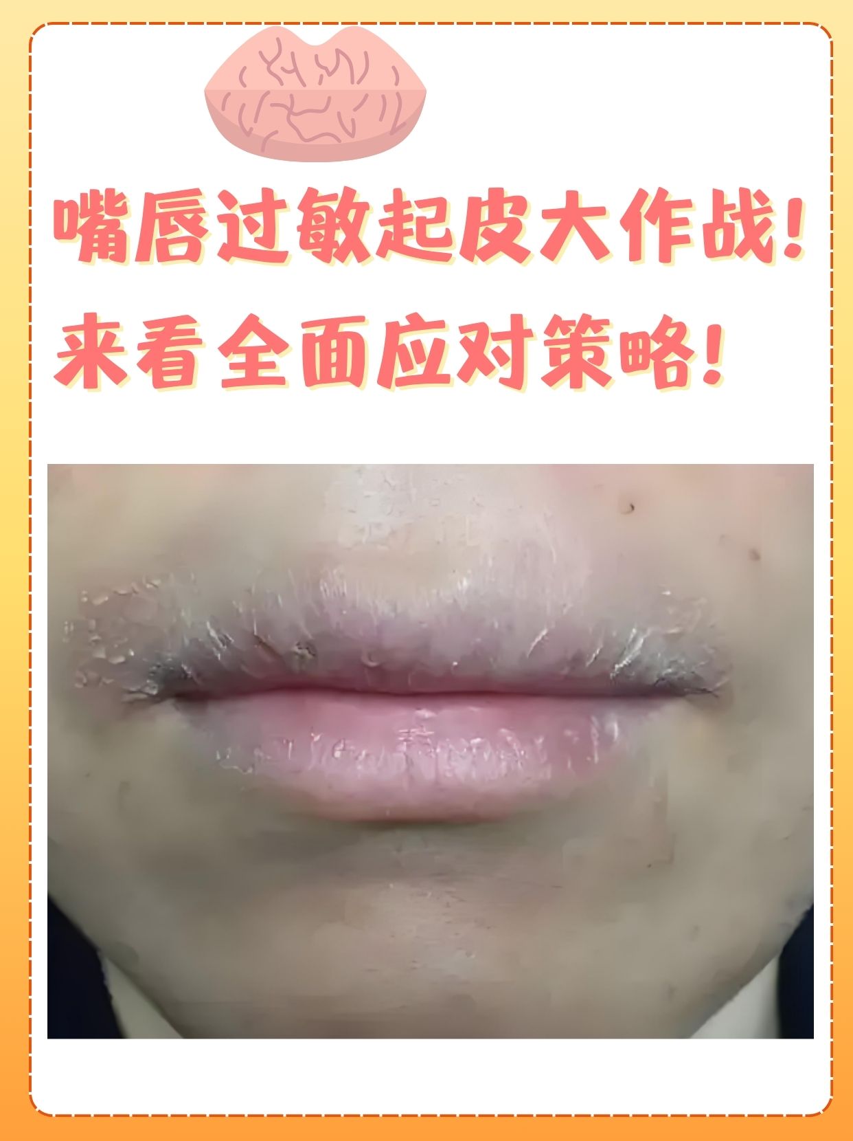 嘴唇经常起皮是什么原因?