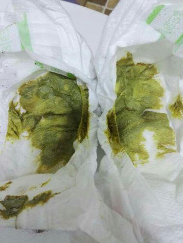 婴儿拉绿屎正常吗