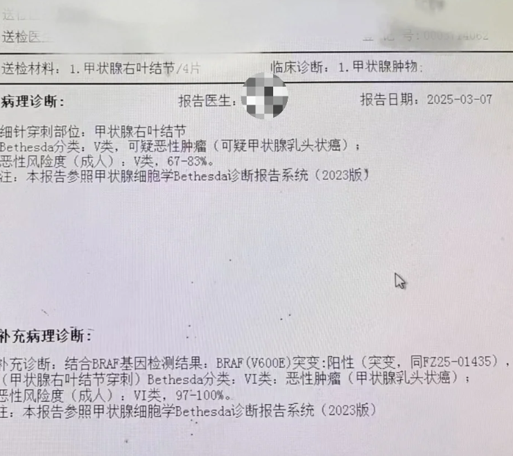 甲状腺癌淋巴结转移严重吗