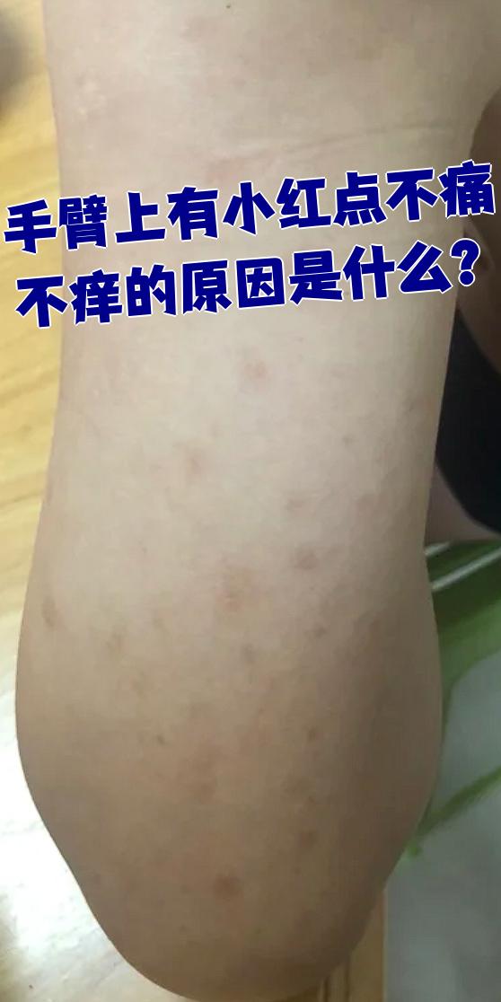 手臂上长红点,什么原因