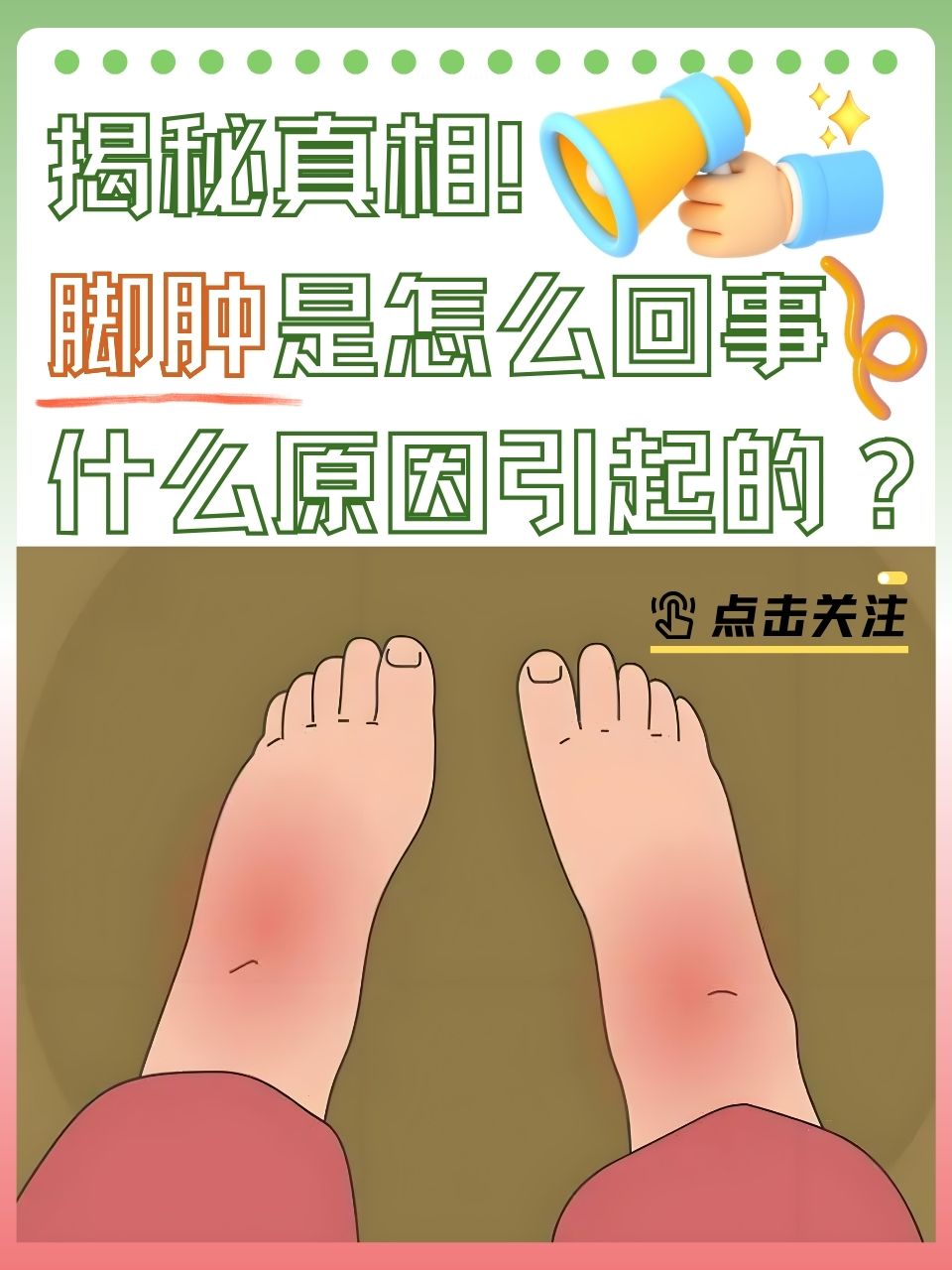 女人脚肿是什么原因?