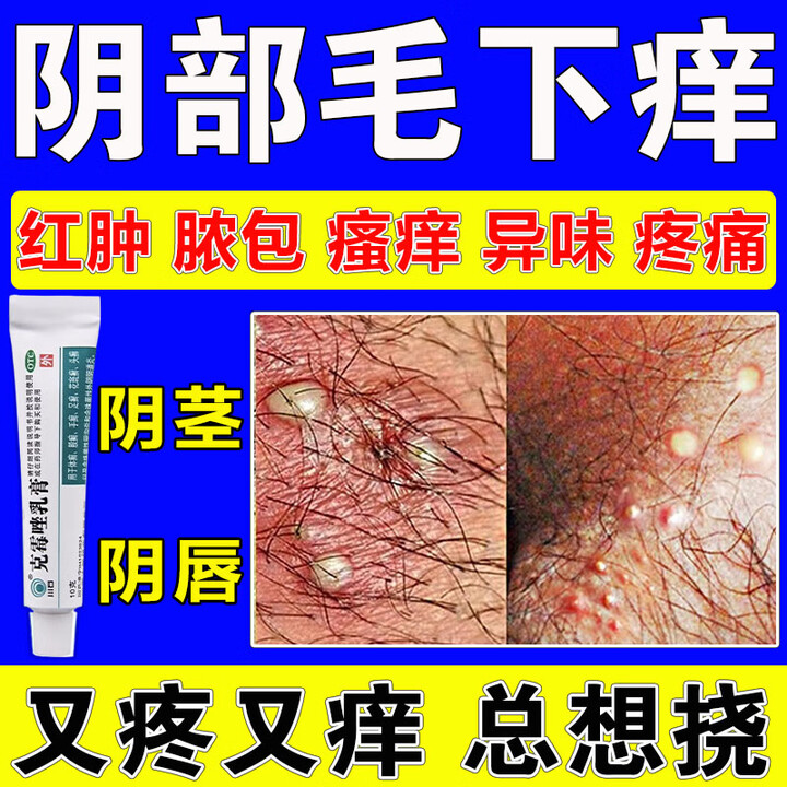 女性的阴部是什么样的?