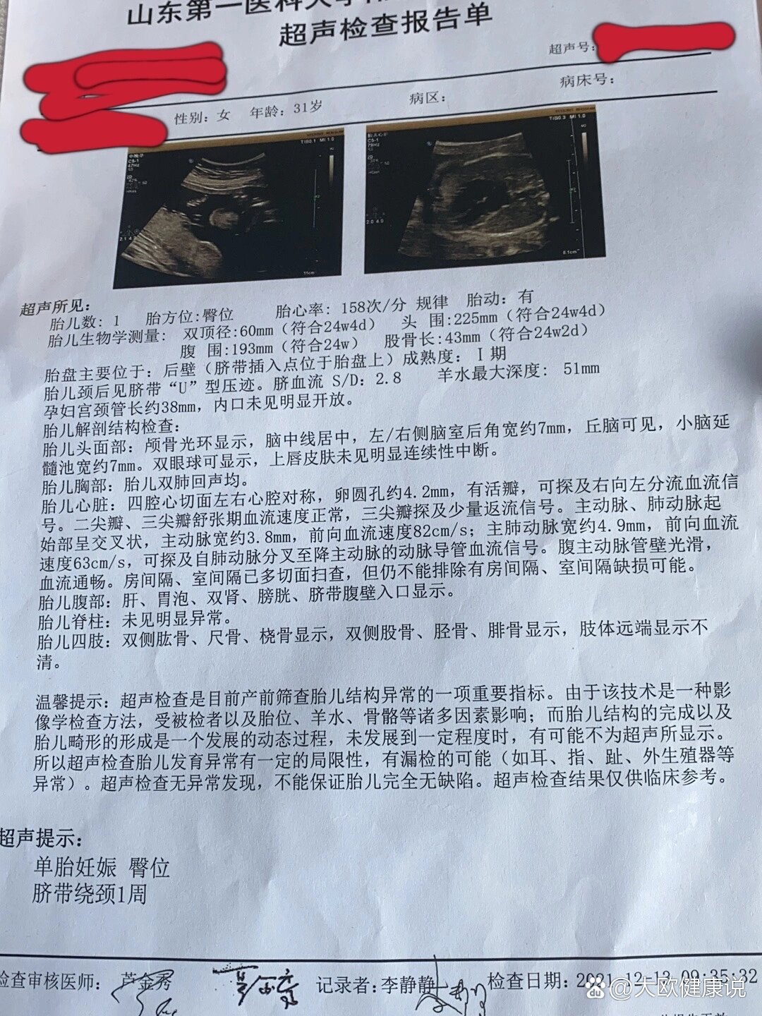 做一个心脏彩超要多少钱