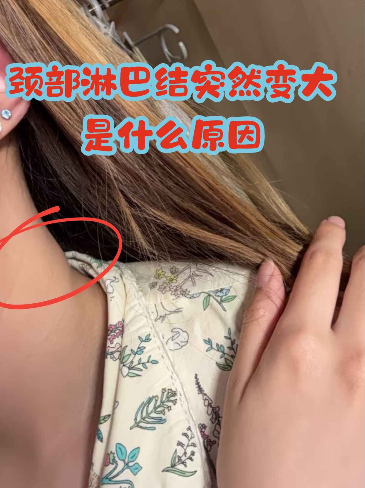 颈部有小淋巴结是得了癌症吗