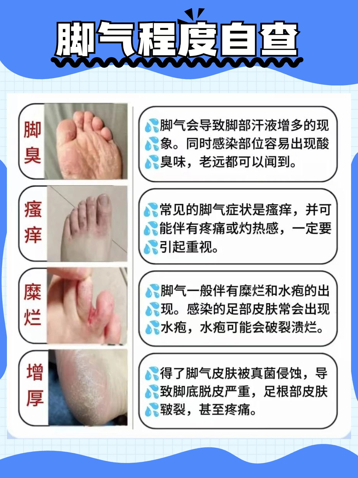 脚脱皮,痒,怎么治疗