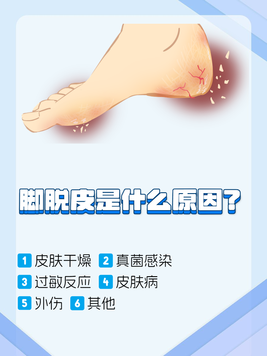 脚干脱皮怎么治疗?