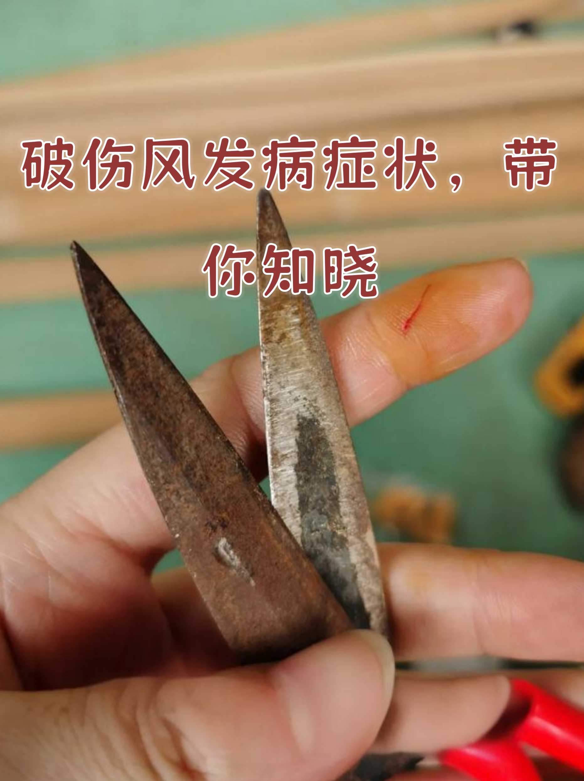 破伤风的症状有哪些？