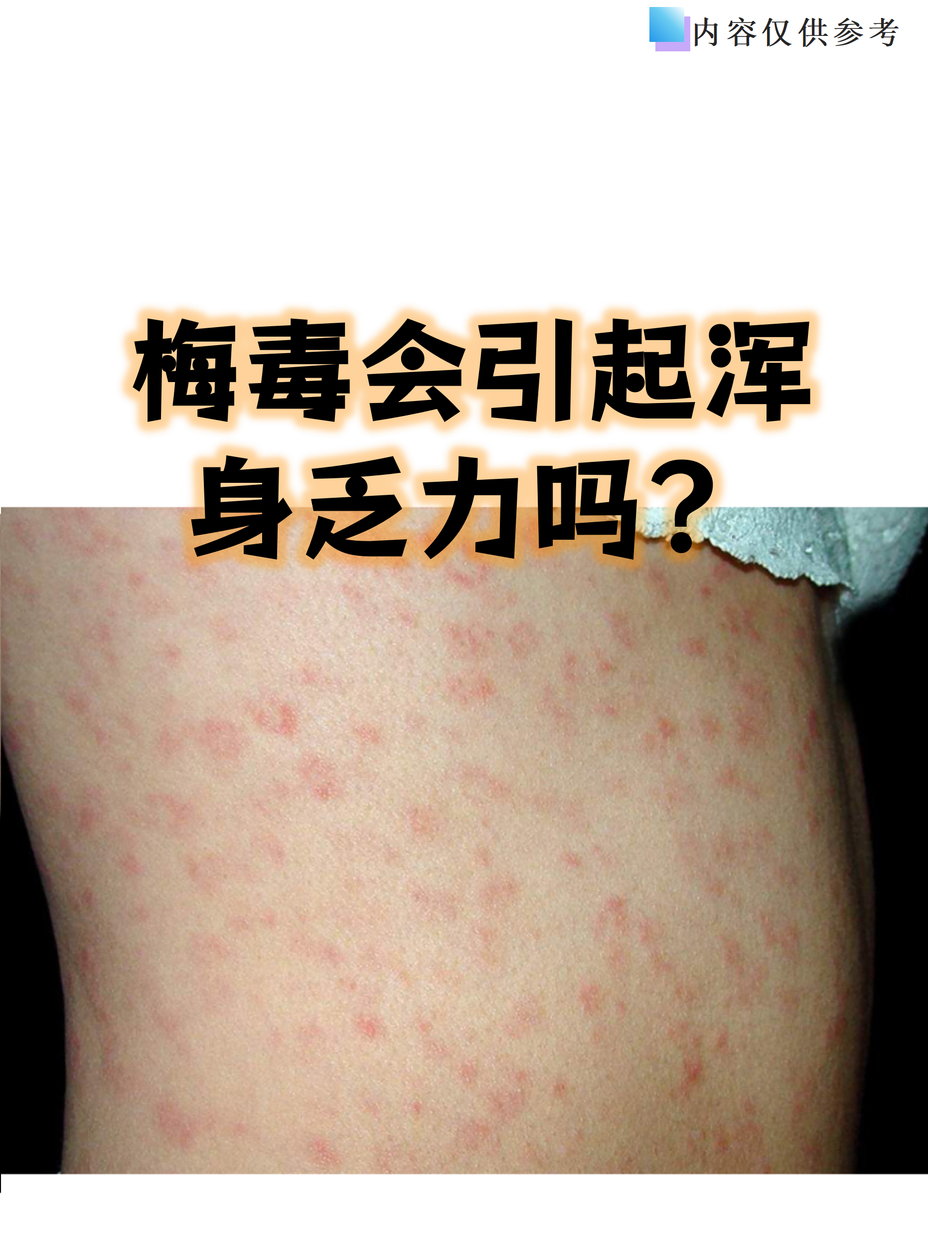 三期梅毒能彻底治愈吗?