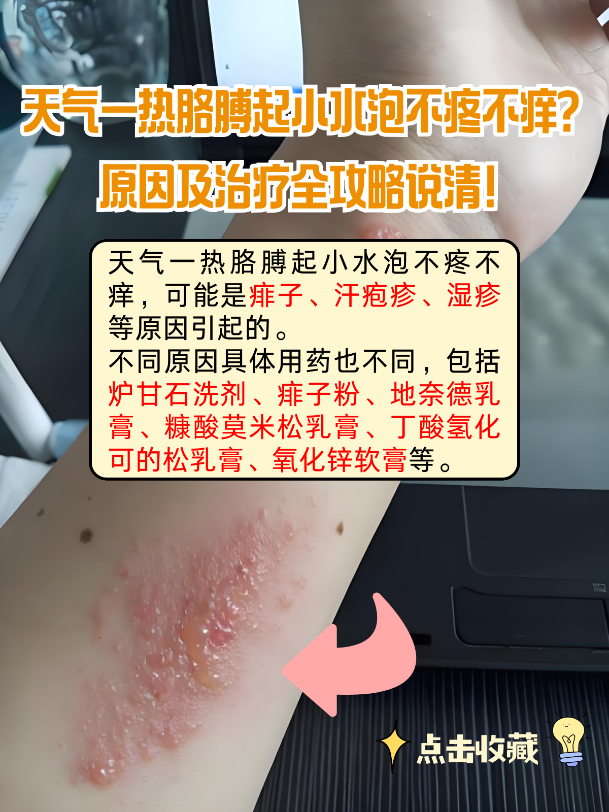 身上长透明的水泡