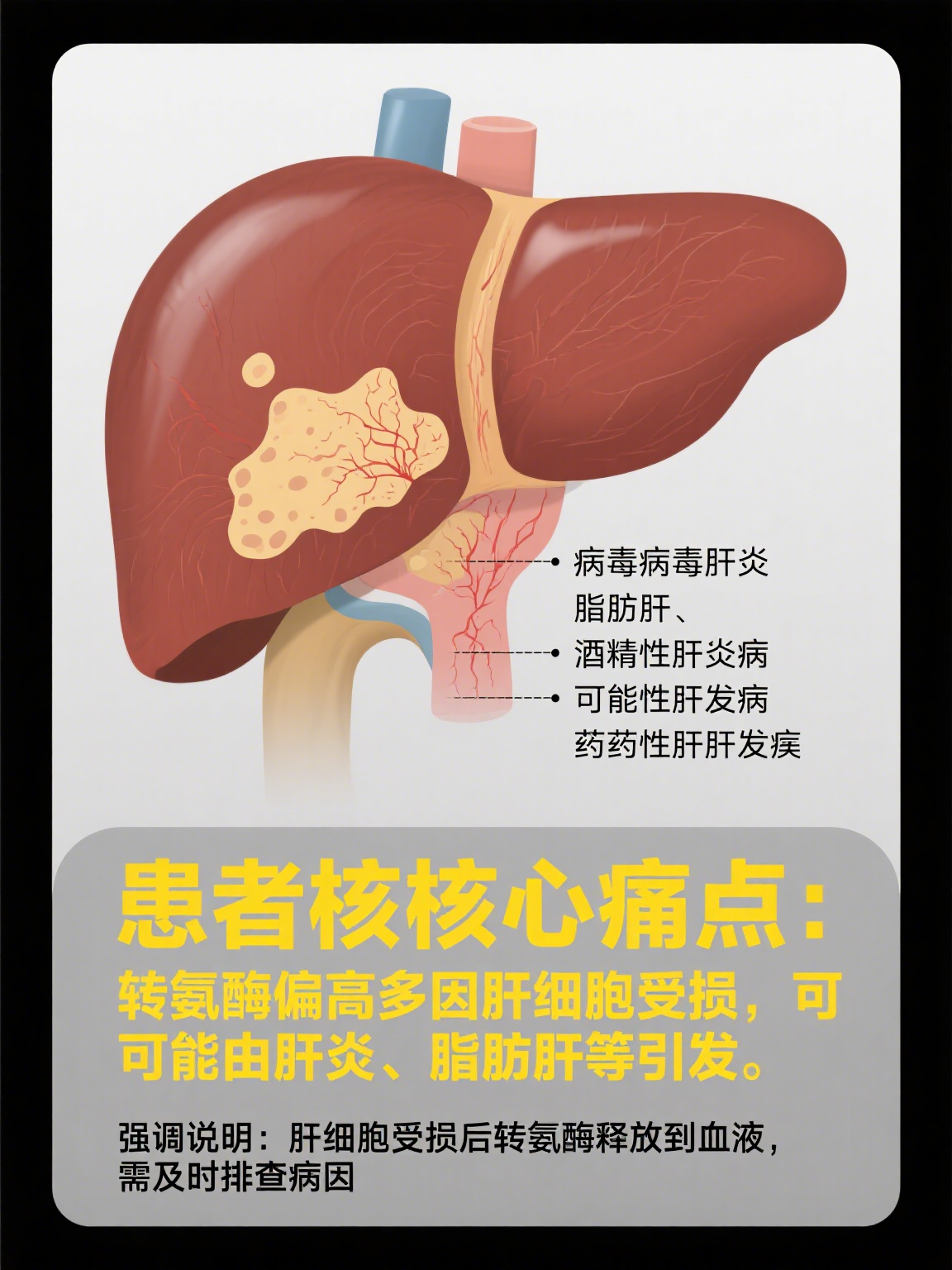 转氨酶高怎么造成的
