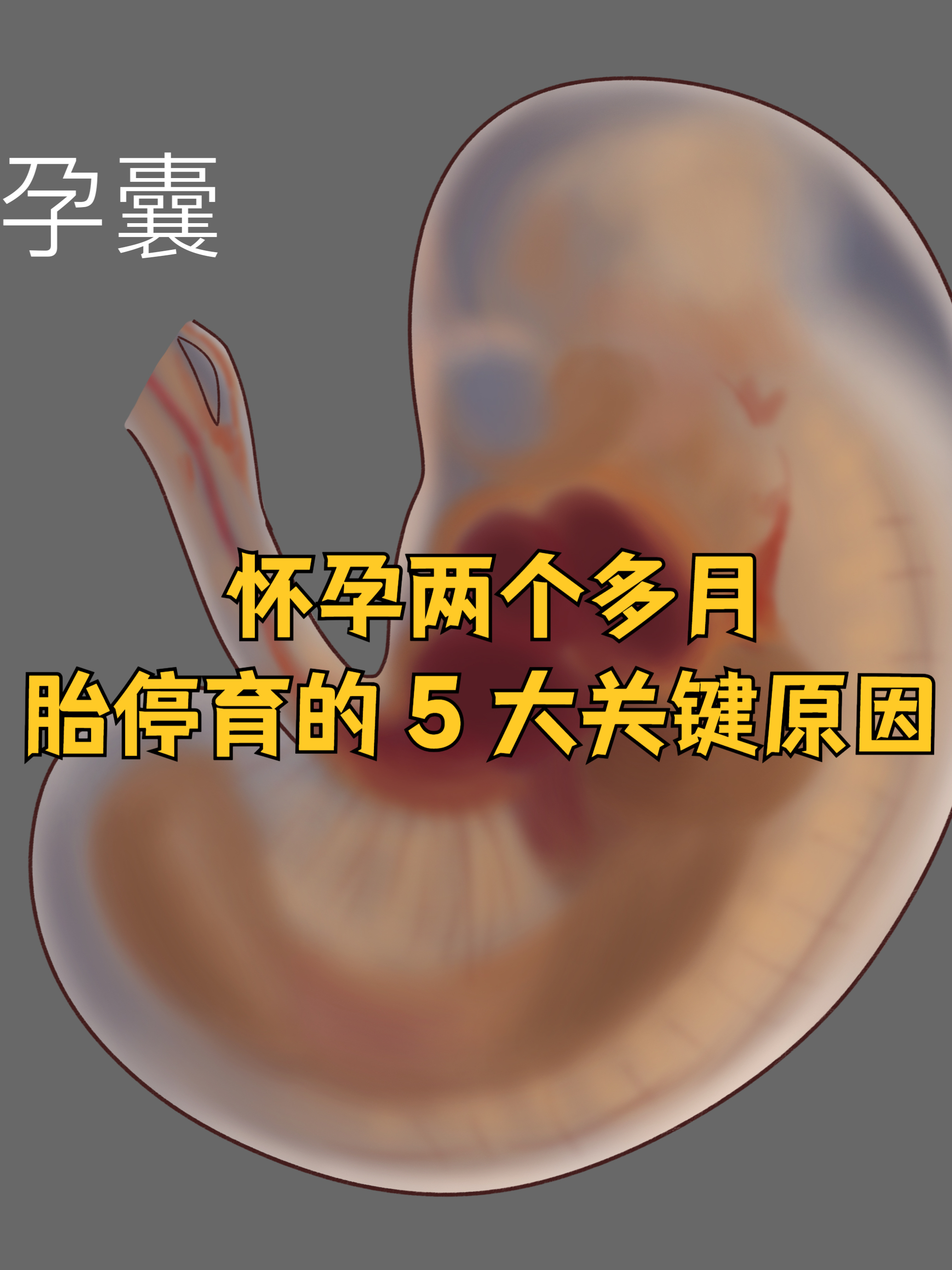 孕8周反应减轻是胎停吗