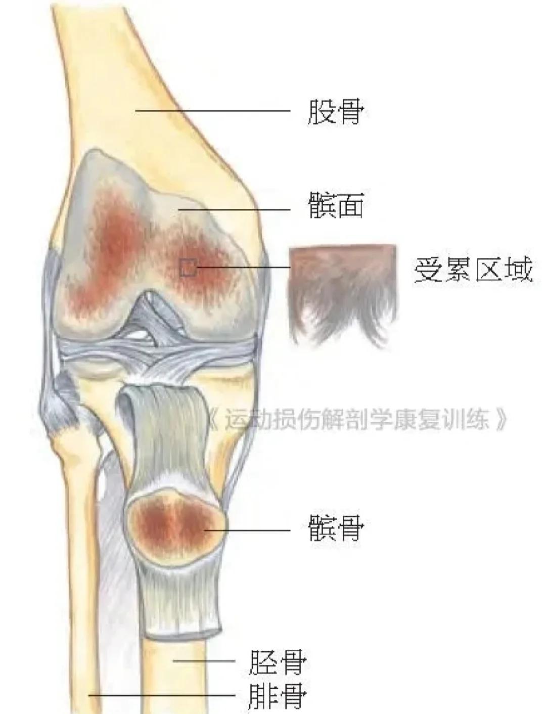 髌骨软骨软化症定义是什么?