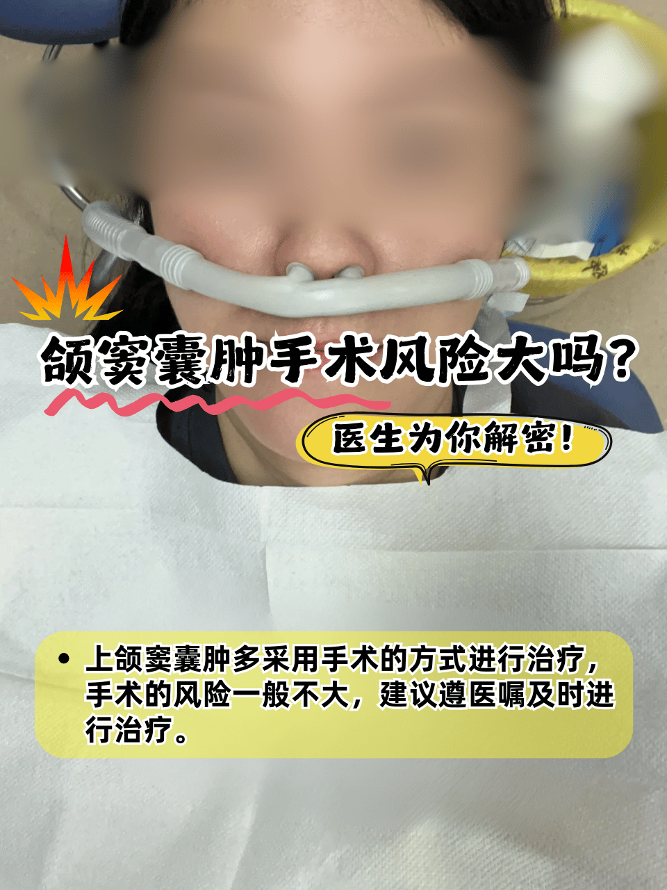 鼻部囊肿是怎么回事