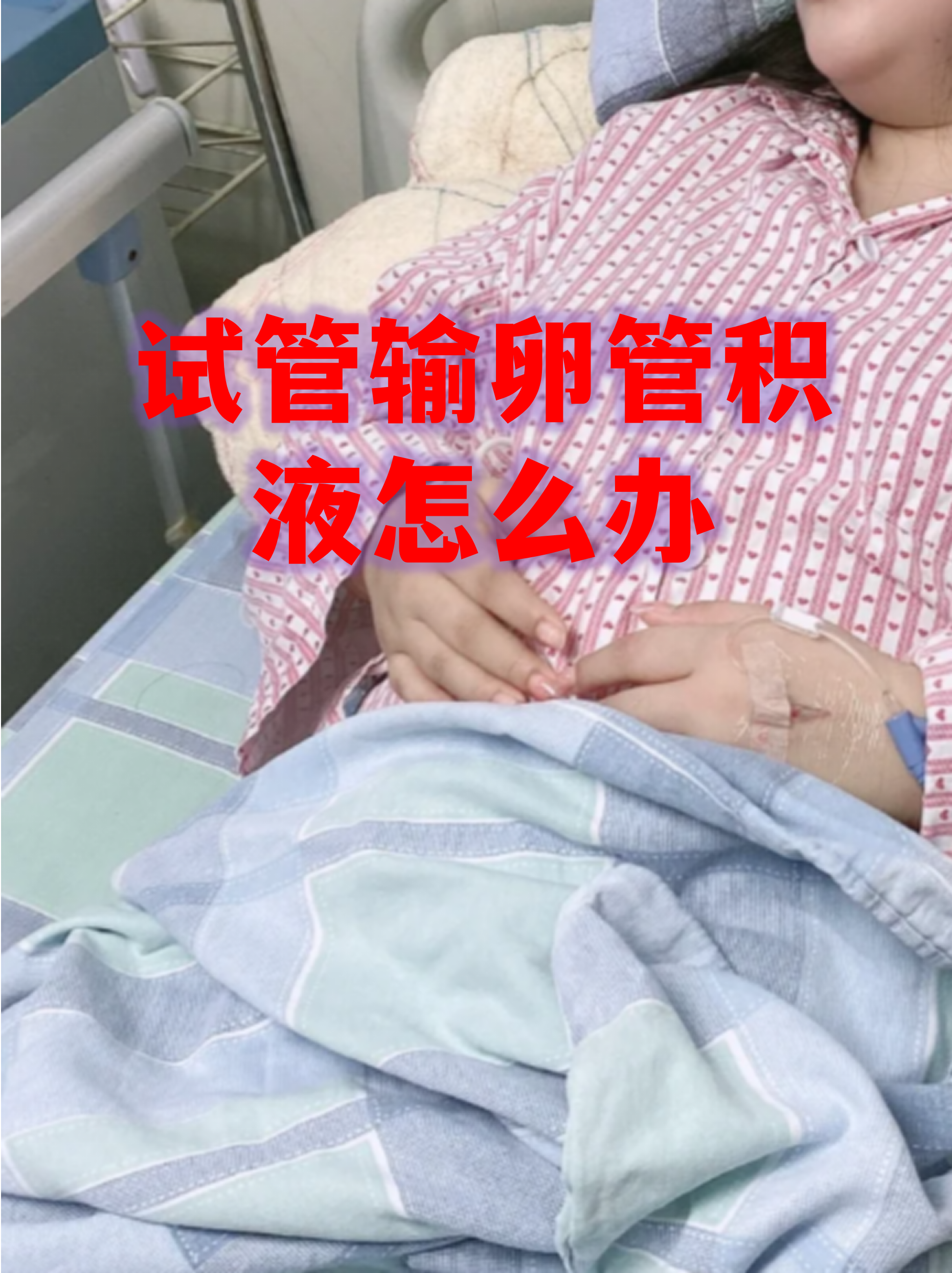 输卵管通水是怎么一回事啊?