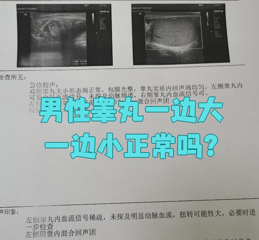 正常睾丸大小是多少