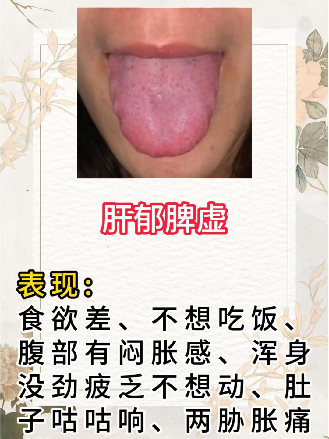 脾功能亢进的表现