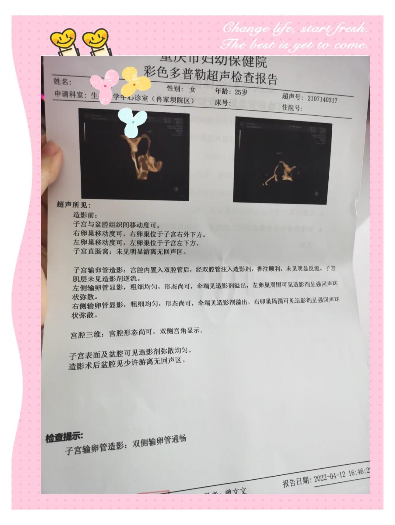 做输卵管造影会痛吗?