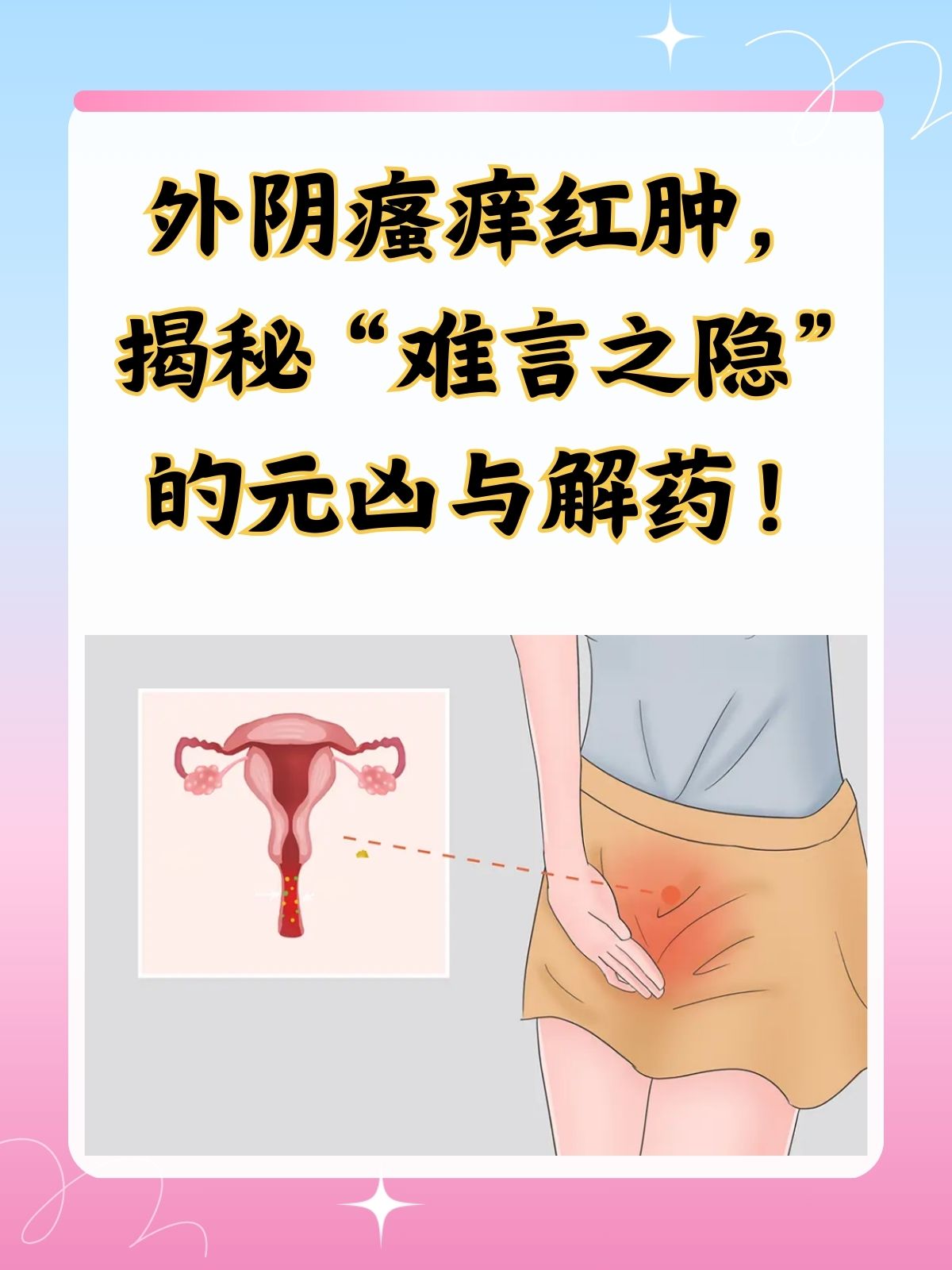 下面痒痒的,怎么办?