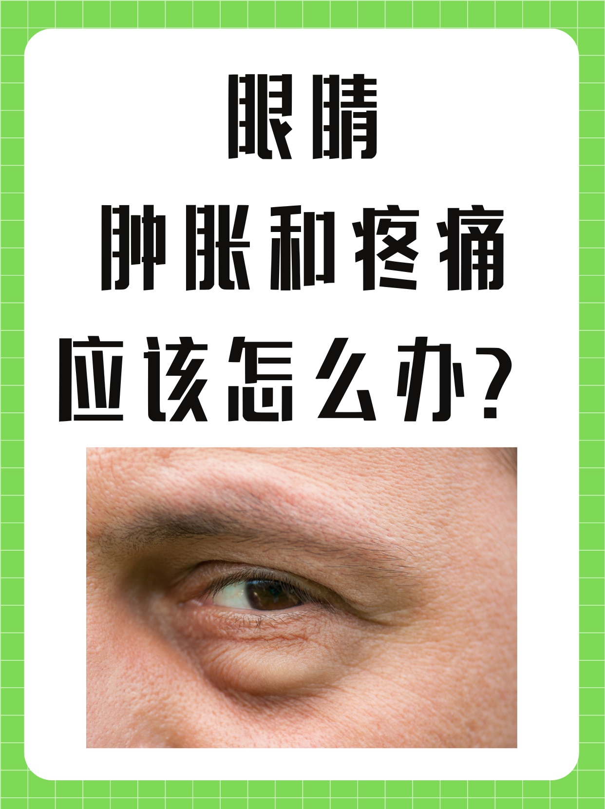 眼睛疼痛怎么办