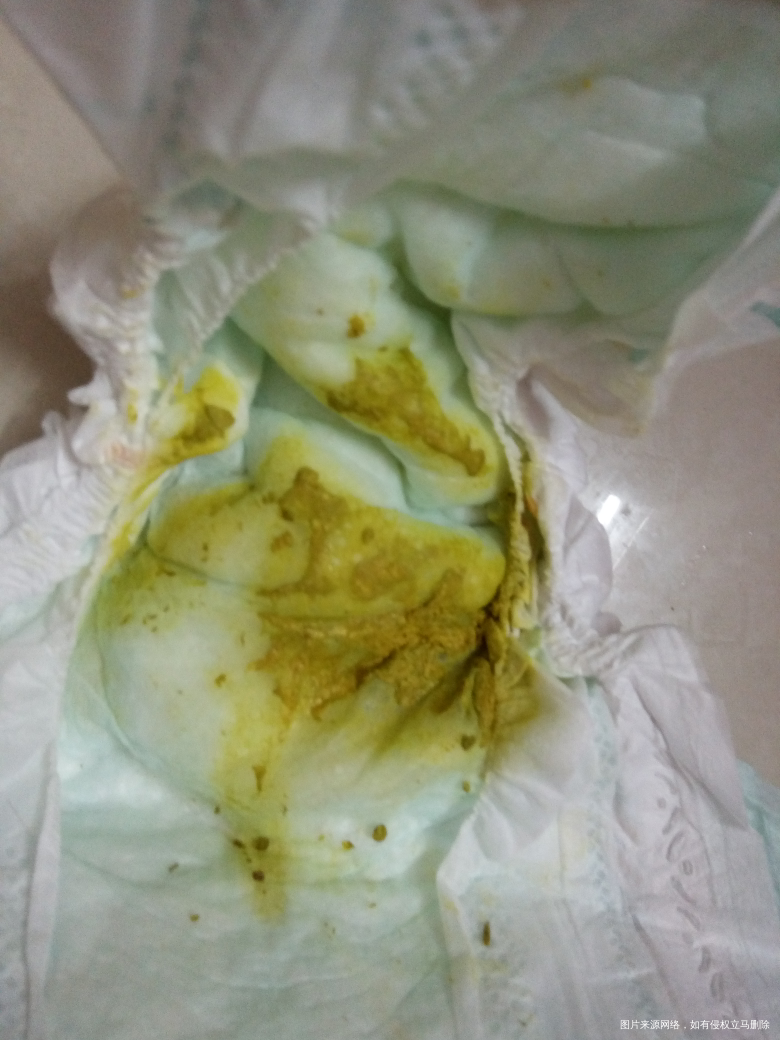 宝宝拉水样便便