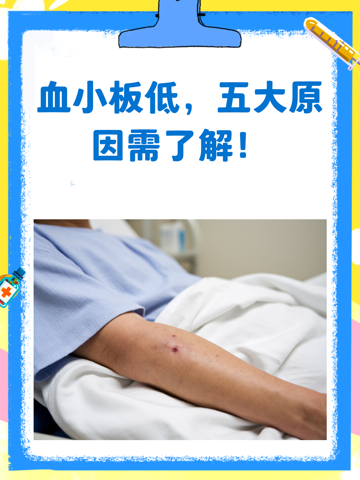 血小板低的原因