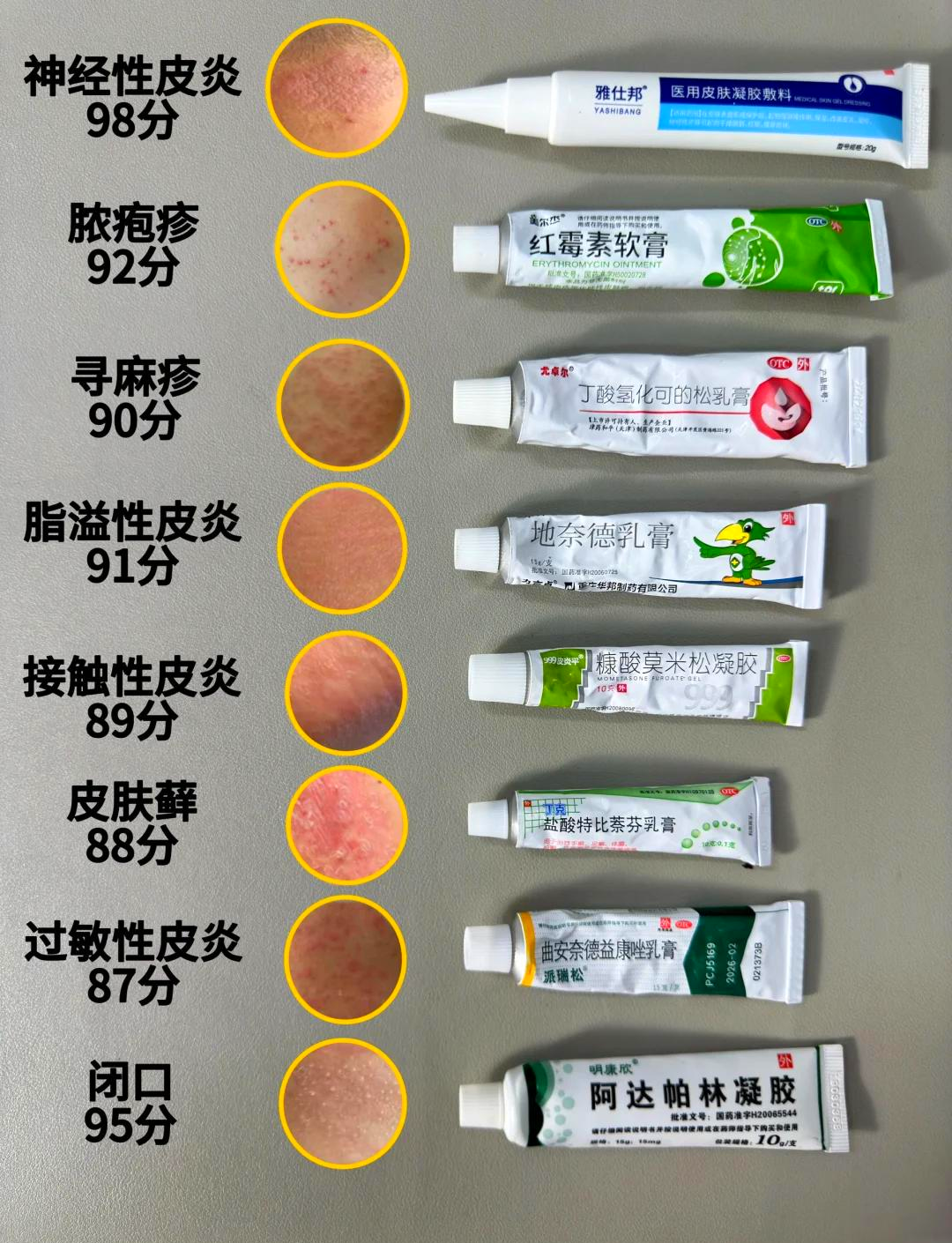 治皮肤过敏的药物有哪些