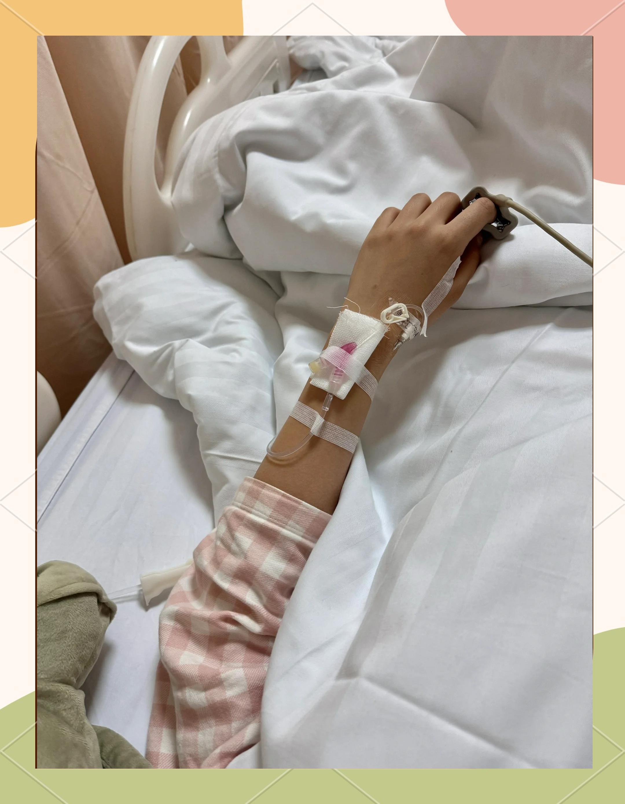 急性阑尾炎手术要住院多久