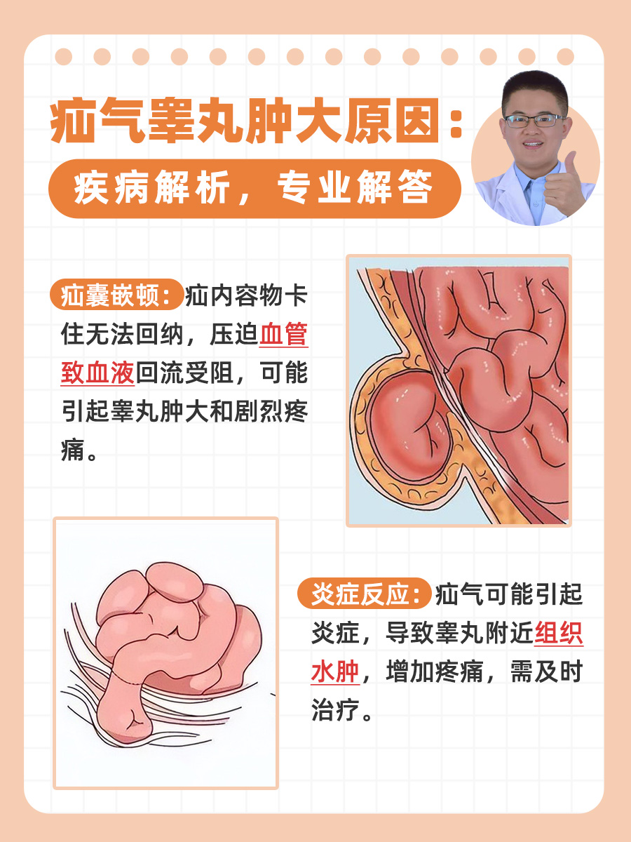 睾丸疝气可以自愈吗