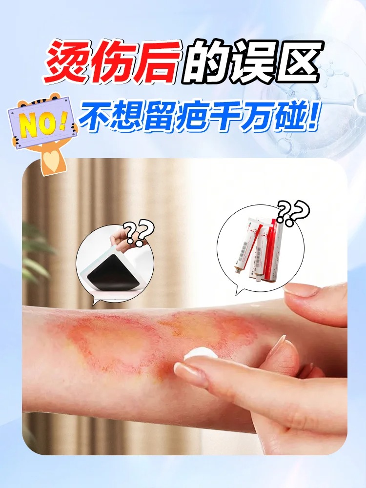 皮肤被开水烫红了,很痛怎么办