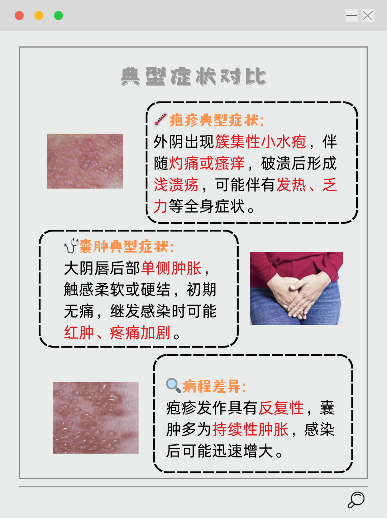 前庭大腺囊肿能过性生活吗?