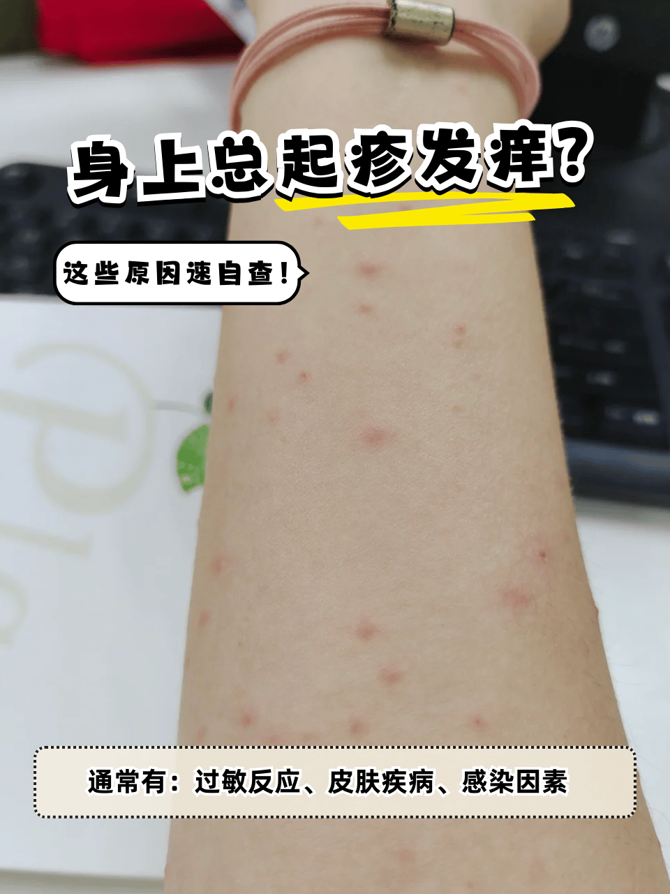 身上什么都没有,就是痒