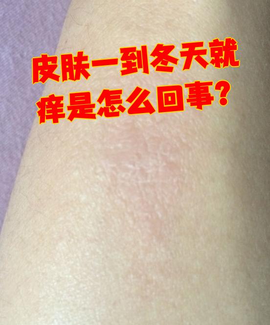 身上什么都没有,就是痒