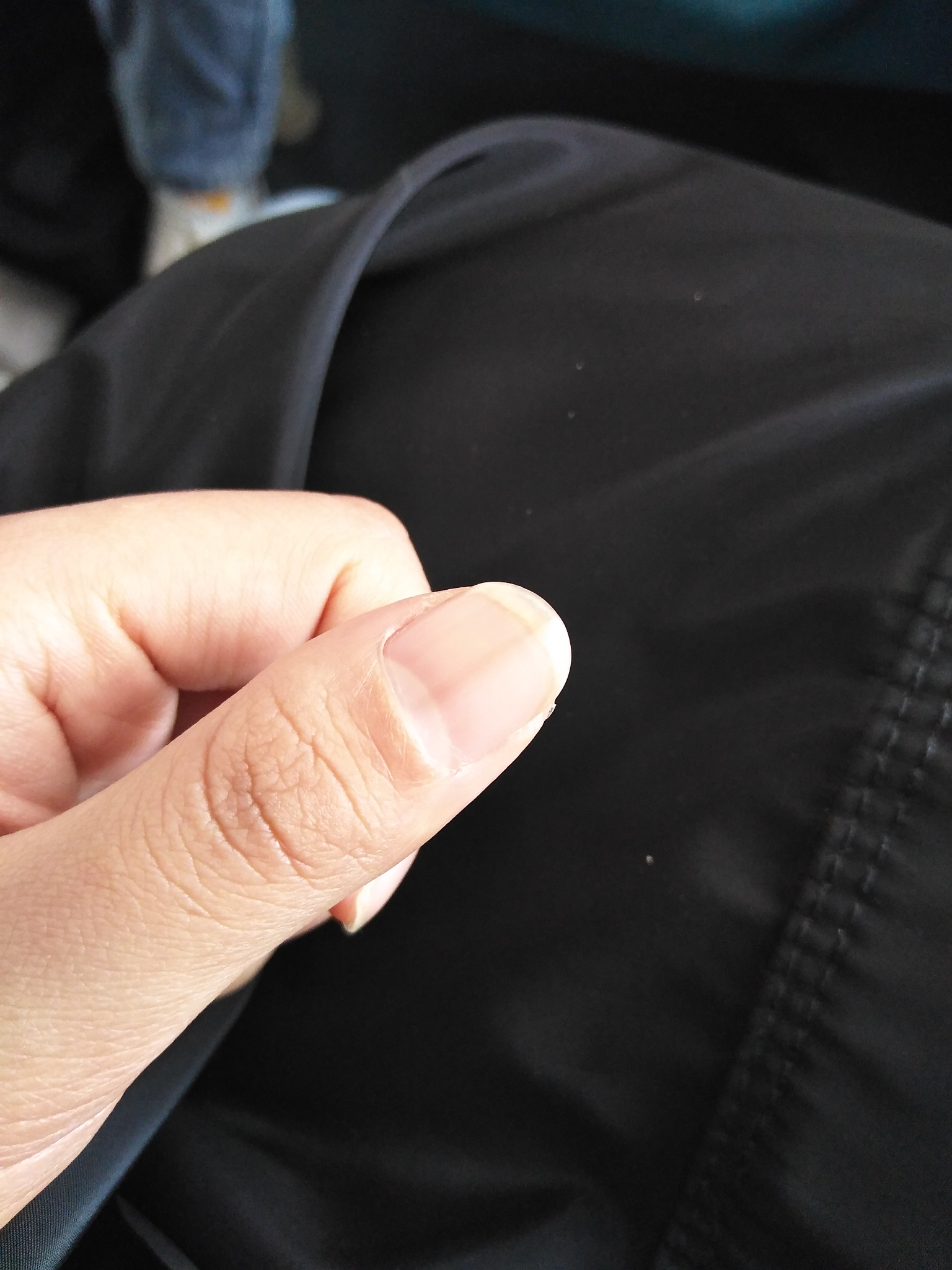 指甲上有黑色竖纹怎么办