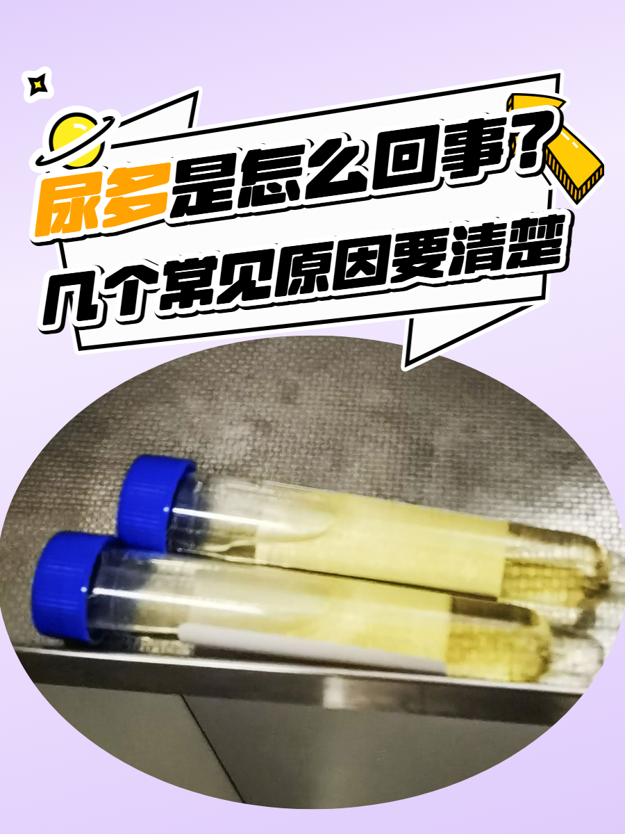 白天尿多是什么原因