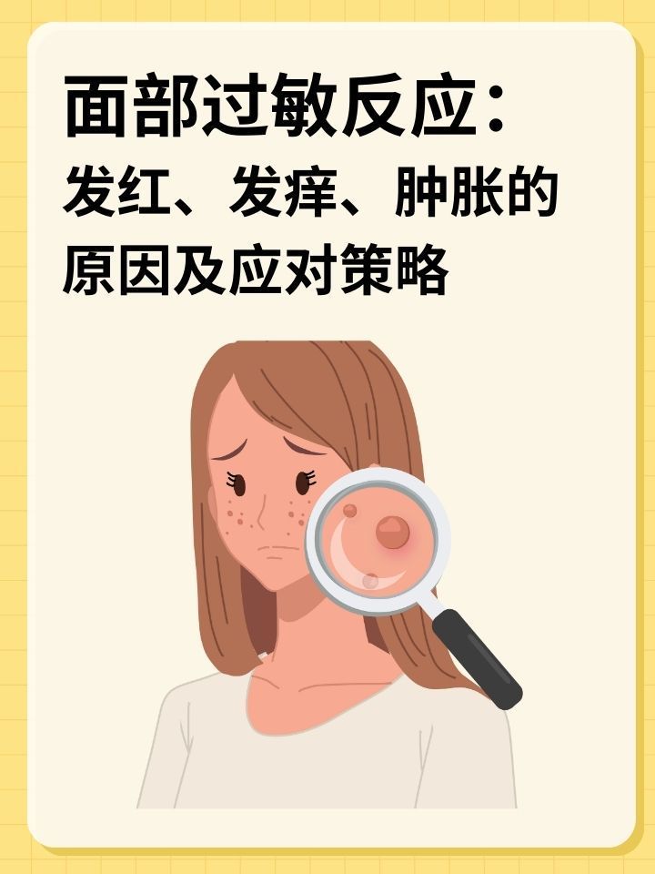脸过敏发红怎么办