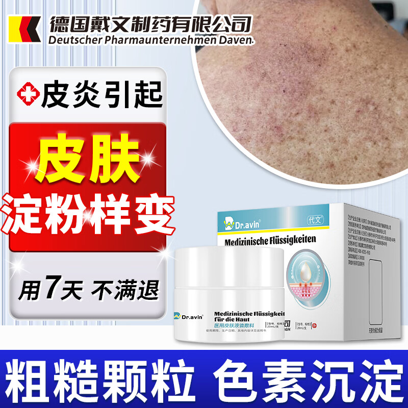 皮肤淀粉样变怎么治疗?