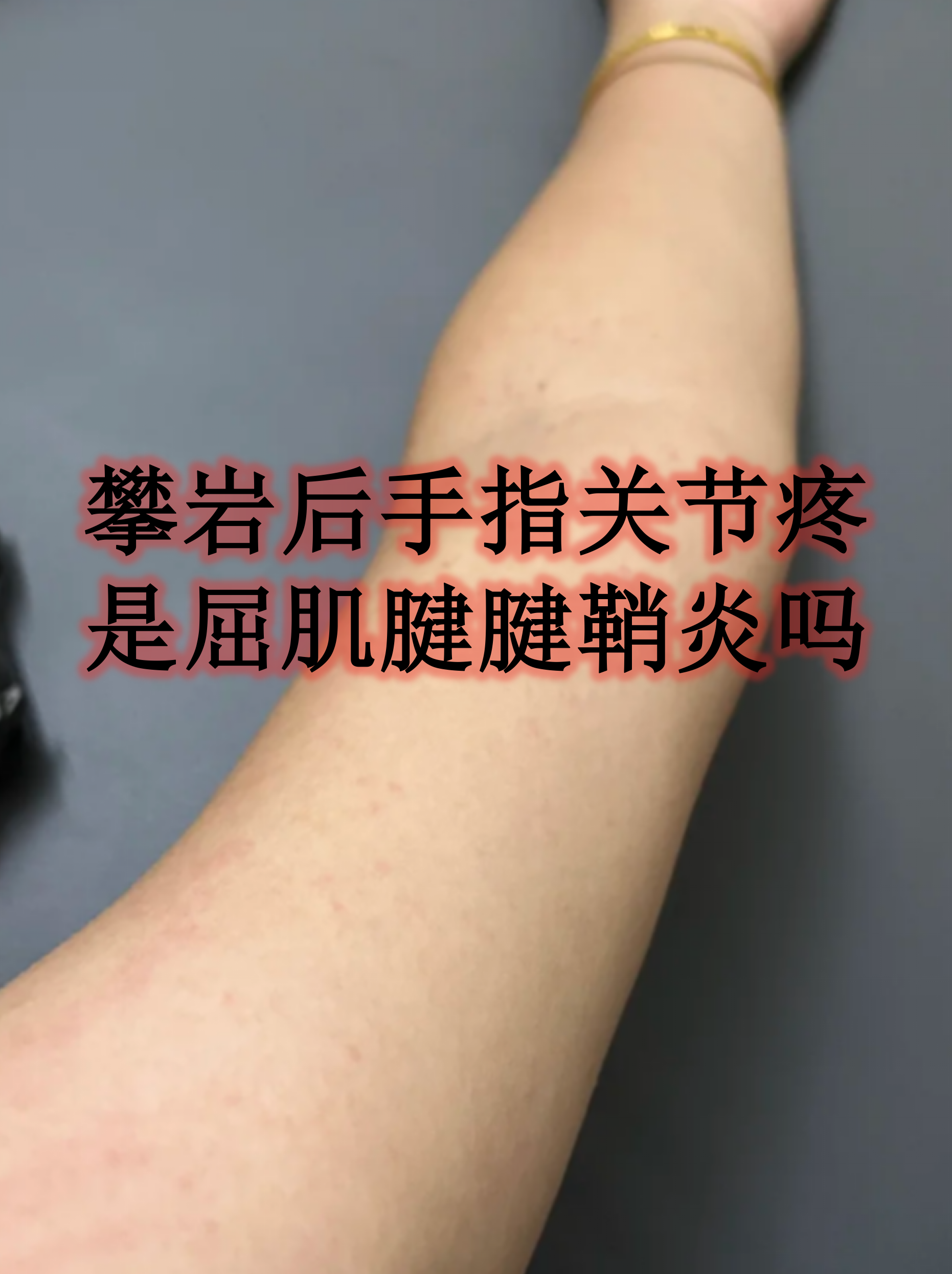 肌腱损伤的症状