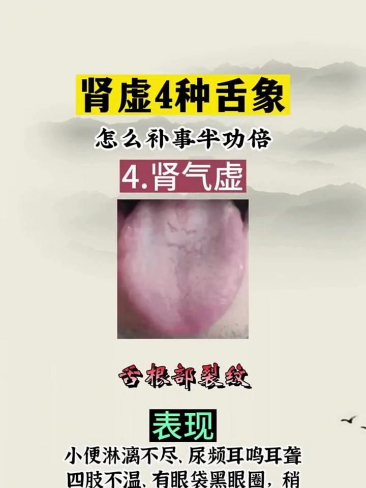 脾肾阳虚是什么症状